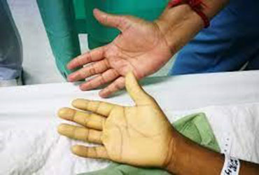 image disease covered