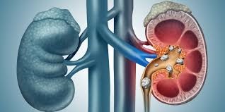 image disease covered