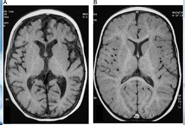 image disease covered