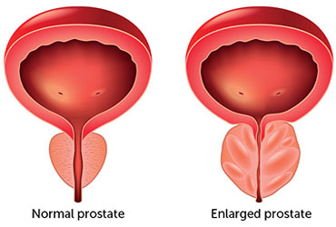 image disease covered