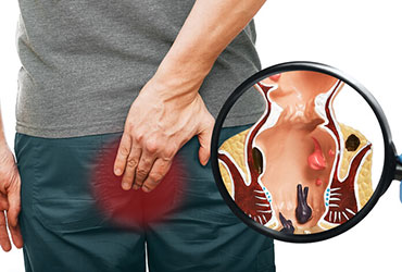 image disease covered