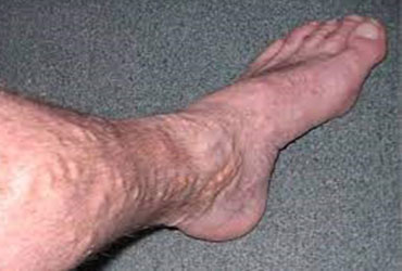 image disease covered